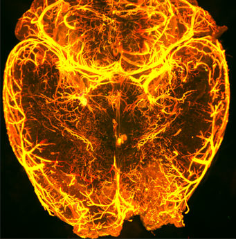 Brain 